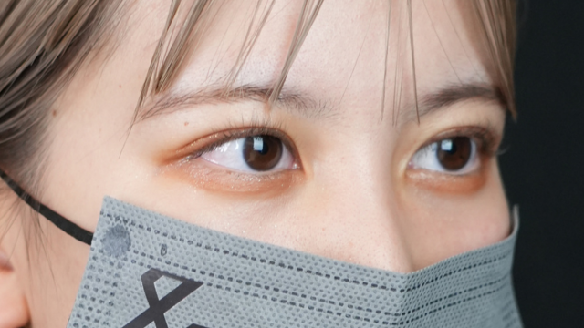 手術前の状態 その1