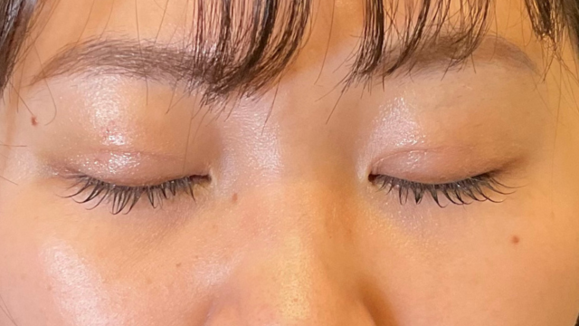 Postoperative Condition Part 1