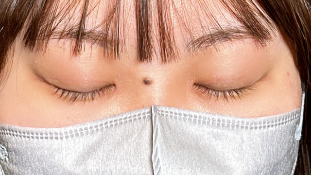 手术前的状态 其一