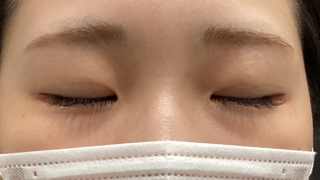 手术前的状态 其一