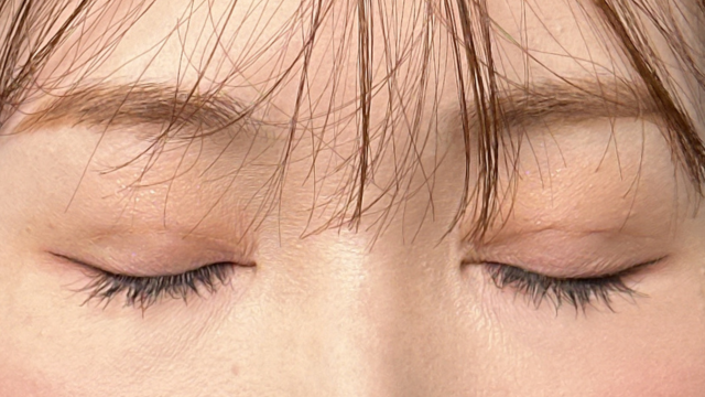 手術前の状態 その1