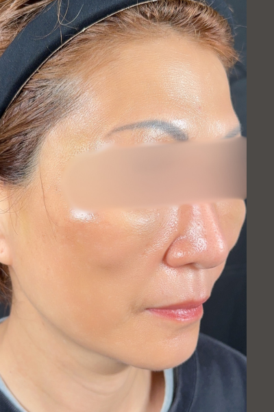 手术前的状态 其一