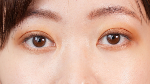 手術前の状態 その1