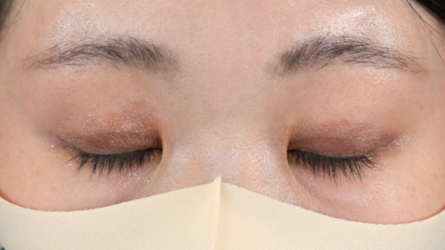 手术前的状态 其一