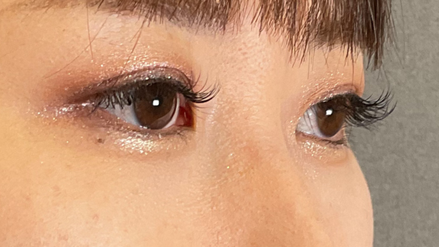 手术前的状态 其一