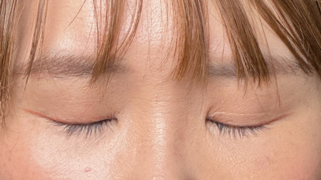 手術前の状態 その1