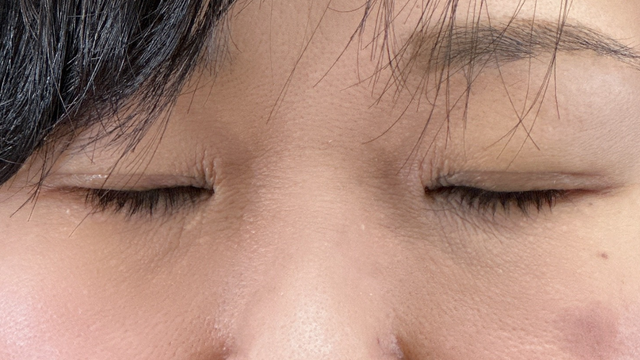 Postoperative Condition Part 1