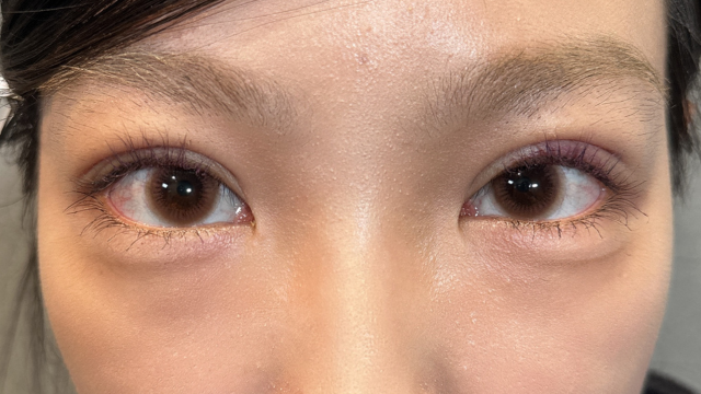 手术前的状态 其一