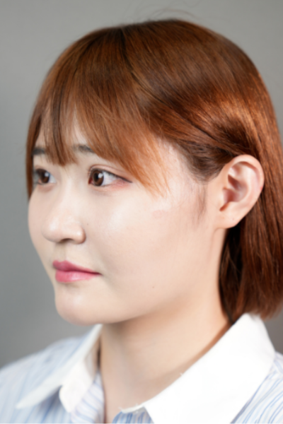 手術前の状態 その1