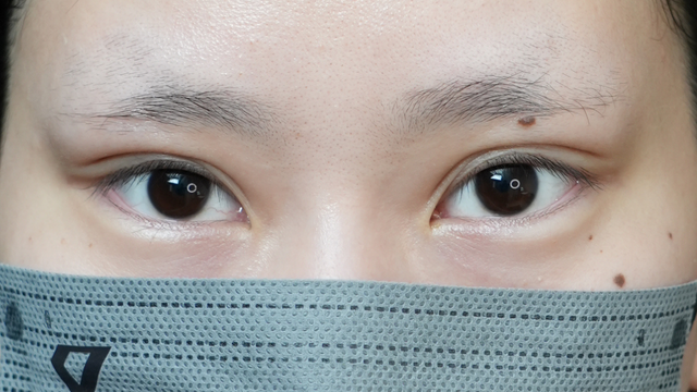 Postoperative Condition Part 1