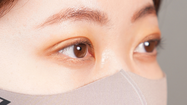 手術前の状態 その1