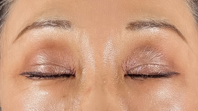 手術前の状態 その1