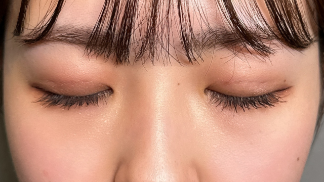 手术前的状态 其一