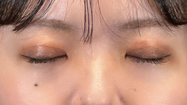 手術前の状態 その1