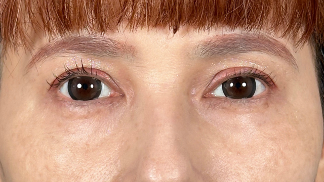 手术前的状态 其一