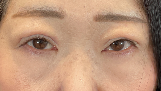 手术前的状态 其一