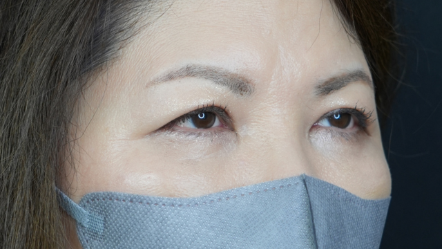 手術前の状態 その1