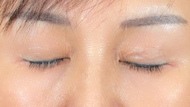 Postoperative Condition Part 1