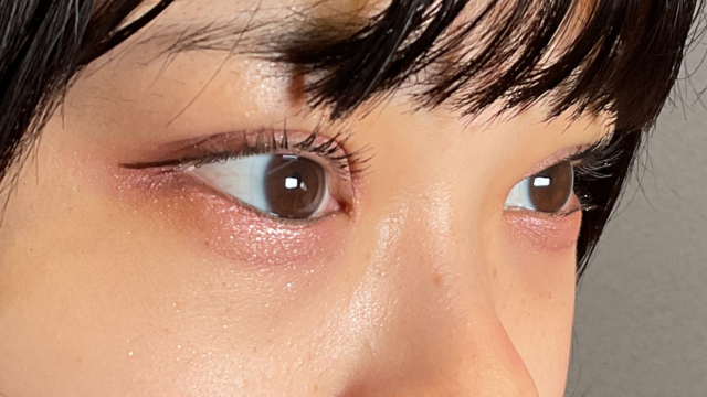 手术前的状态 其一