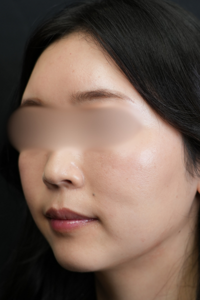 Postoperative Condition Part 1