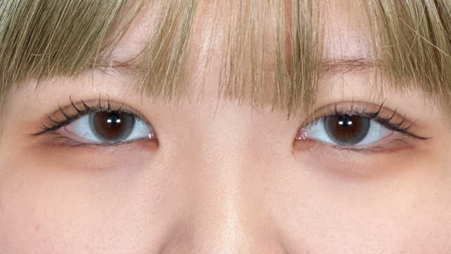 手术前的状态 其一