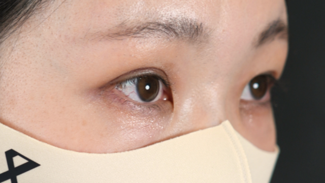 手术前的状态 其一