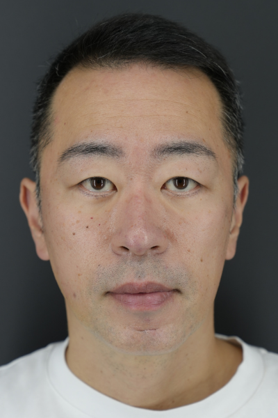 手術前の状態 その1