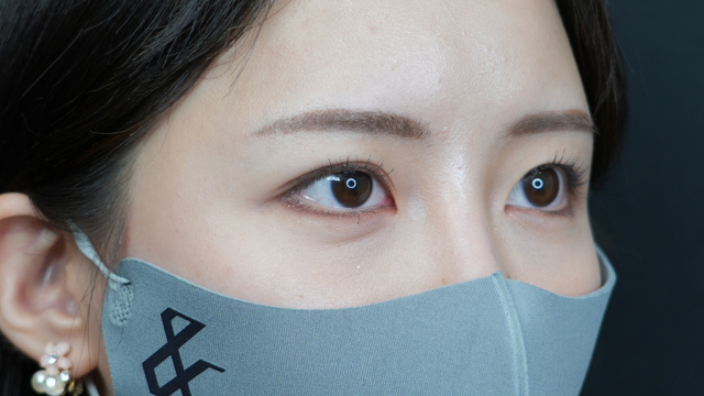 手术前的状态 其一