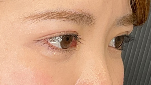 手术前的状态 其一