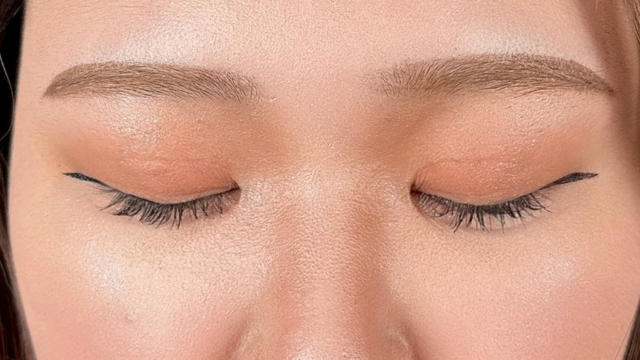 手术前的状态 其一