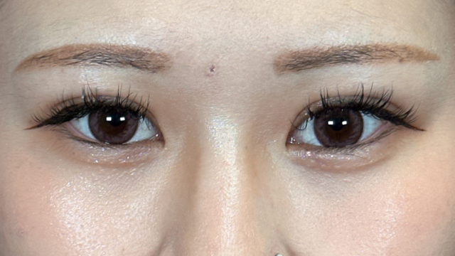 手术前的状态 其一