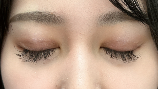 Postoperative Condition Part 1