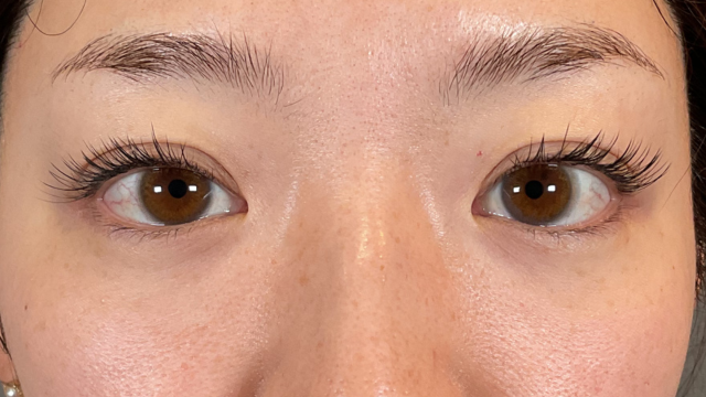 手术前的状态 其一