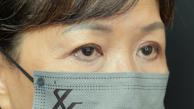 手术前的状态 其一