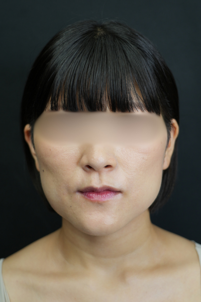 手术前的状态 其一