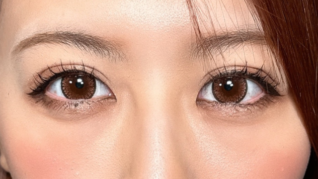 手术前的状态 其一