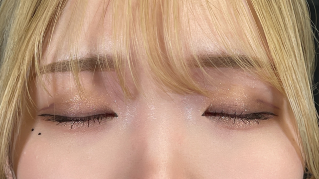 手術前の状態 その1