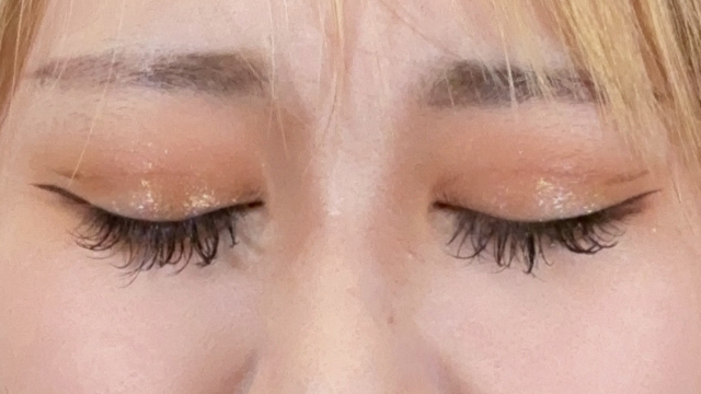 Postoperative Condition Part 1