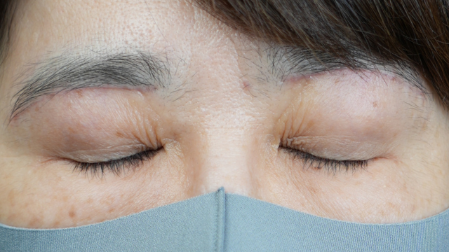 Postoperative Condition Part 1