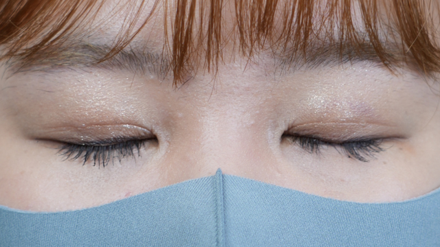 手术前的状态 其一