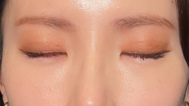 手术前的状态 其一