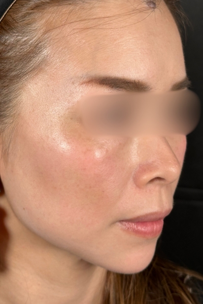 手术前的状态 其一