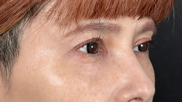 手术前的状态 其一