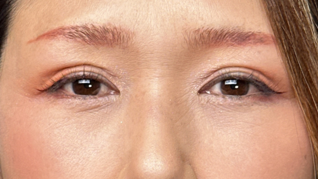 Postoperative Condition Part 1