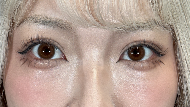 手术前的状态 其一