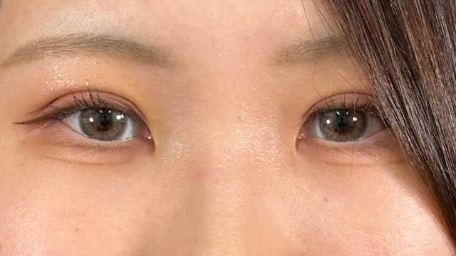 手术前的状态 其一