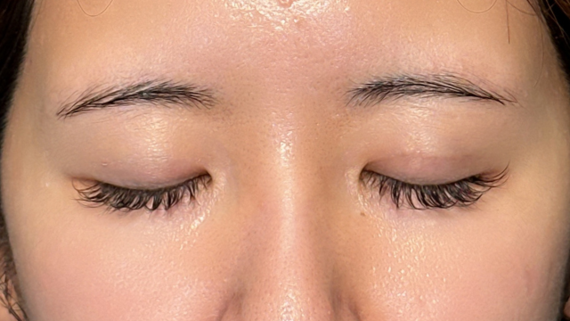 手术前的状态 其一