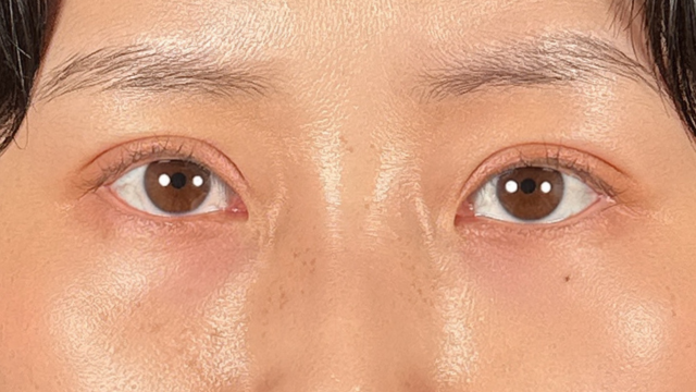 手术前的状态 其一