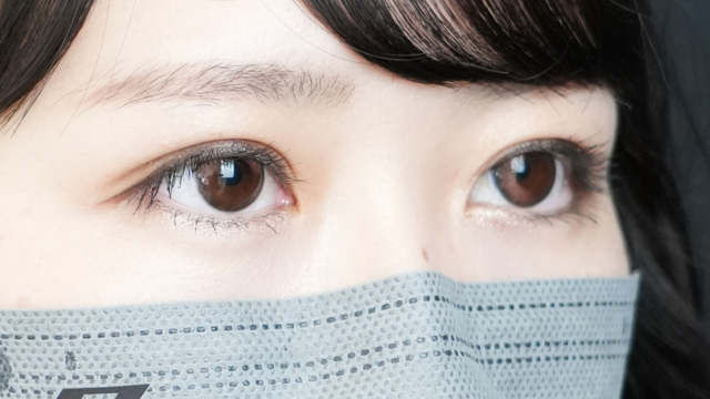 手术前的状态 其一