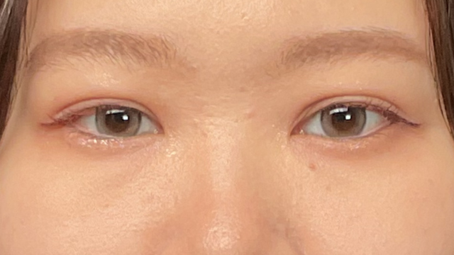 Postoperative Condition Part 1